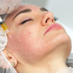 benefits of prp