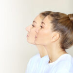 chin augmentation
