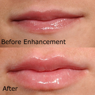 Lip Example